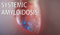 Systemic amyloidosis MOD